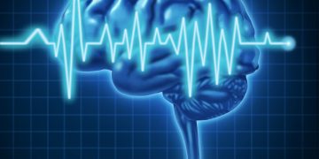 Qu'est-ce que CVA? – Oren Zarif